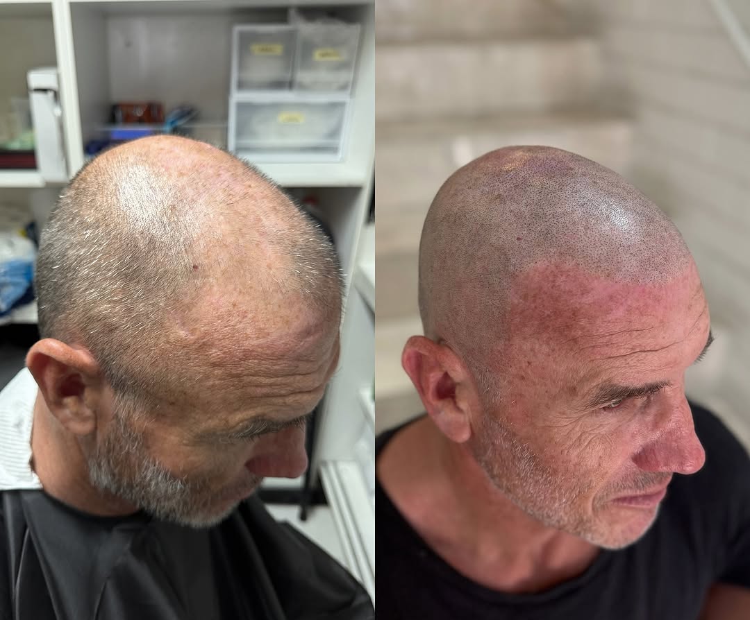 ScalpDynamics tattoo 10