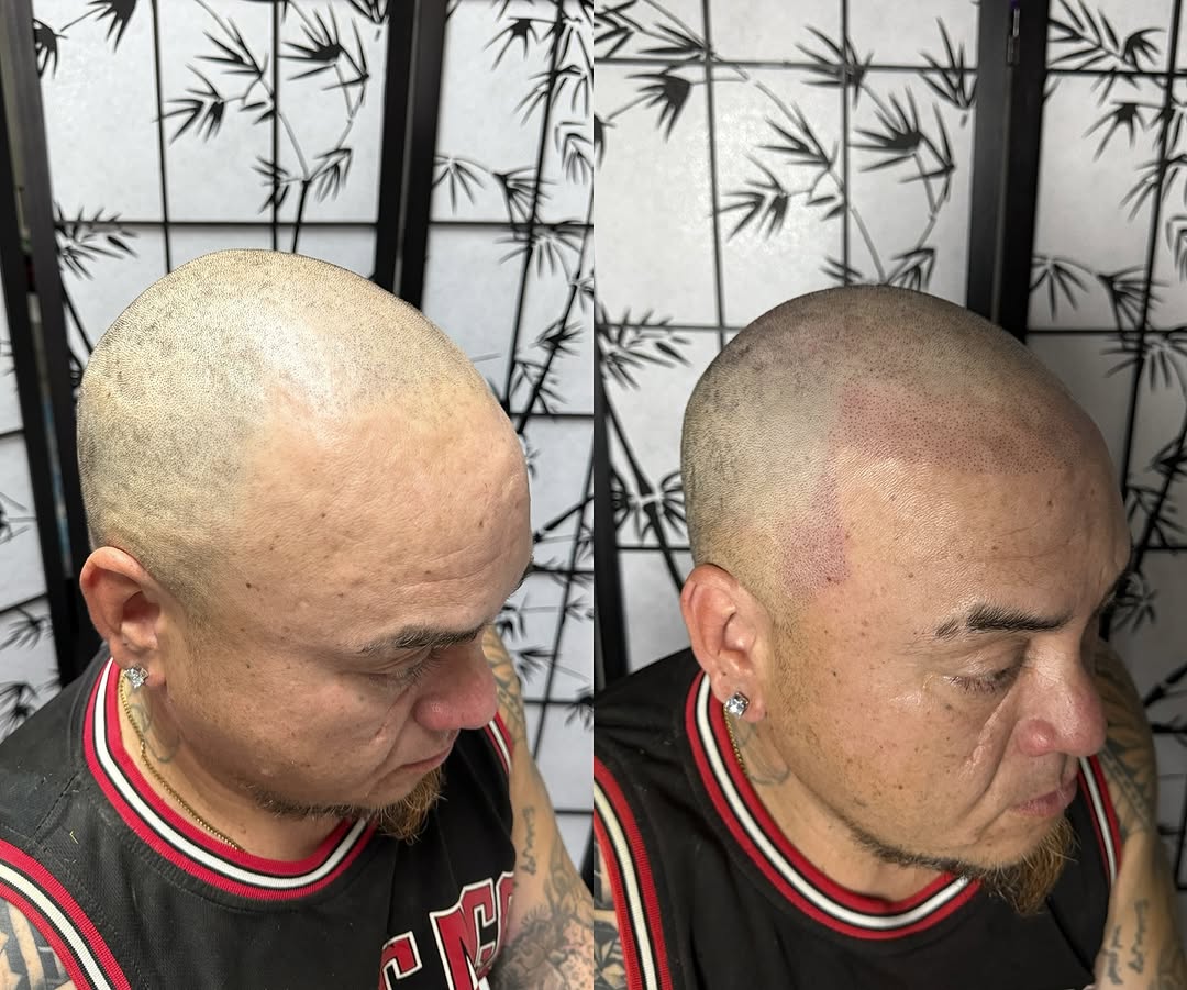 ScalpDynamics tattoo 12