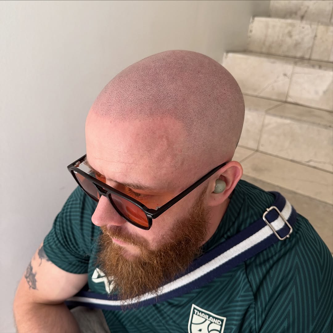 ScalpDynamics tattoo 15