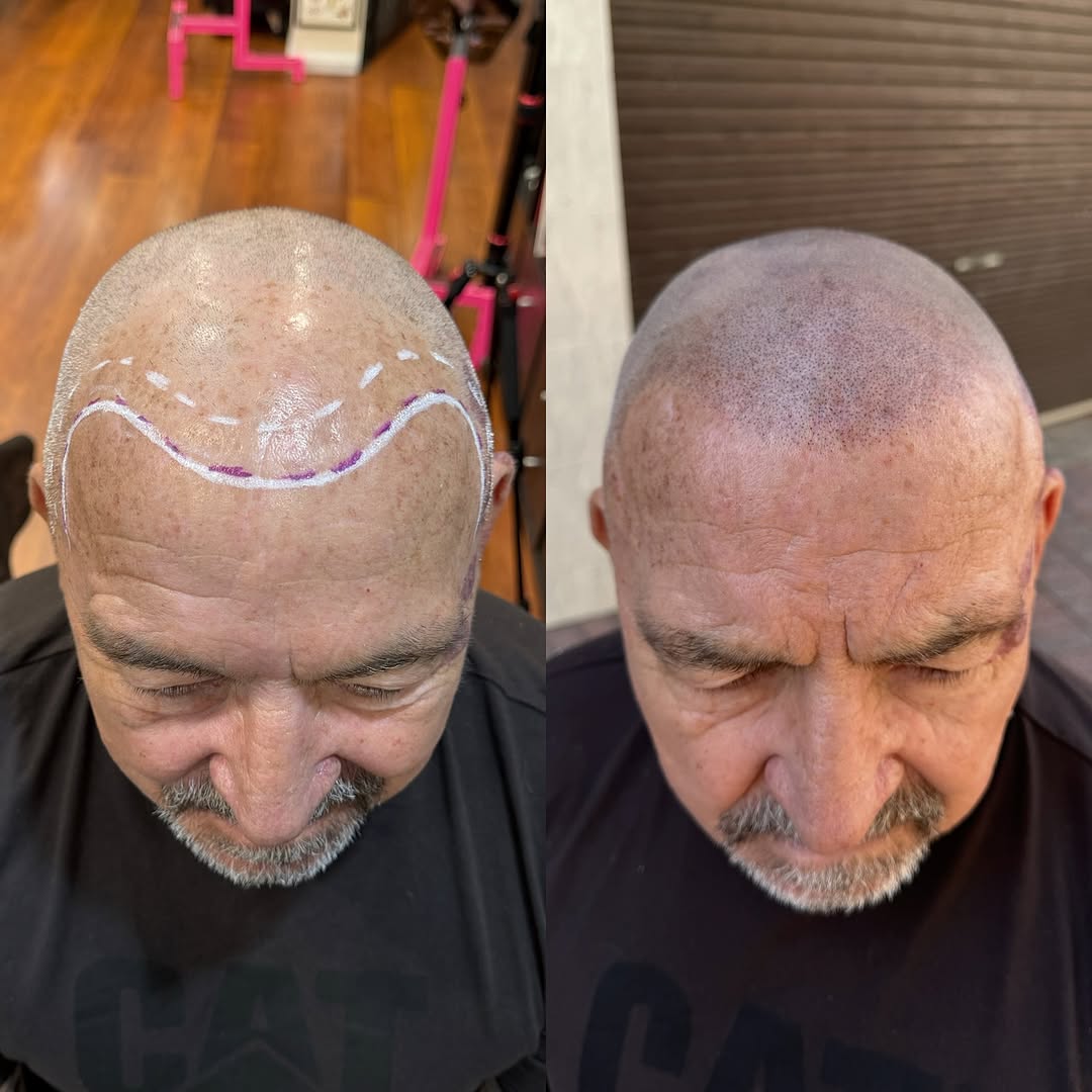 ScalpDynamics tattoo 16