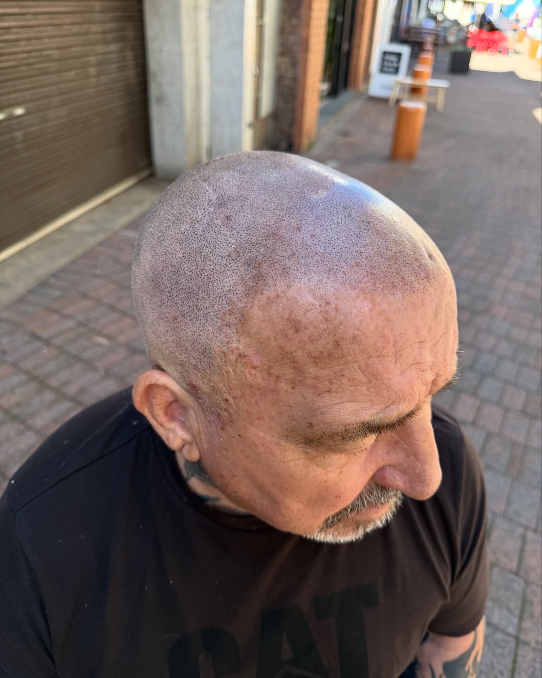 ScalpDynamics tattoo 8