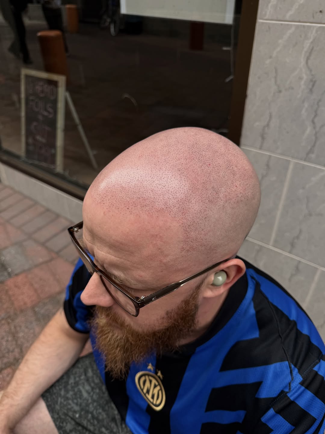 ScalpDynamics tattoo 9