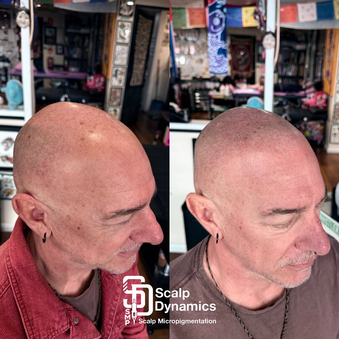 ScalpDynamics work 33